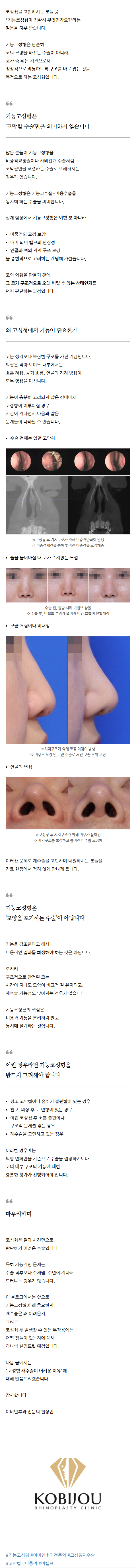 비중격만곡증코수술 qyjjc