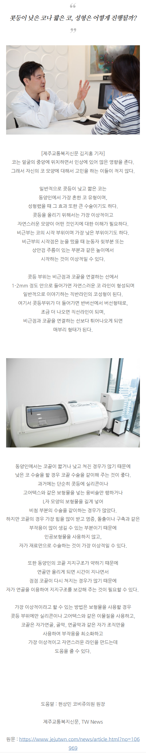 기능코수술 fzaye