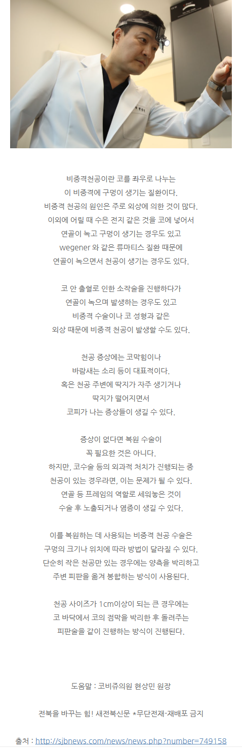 매부리코교정 fzeyo
