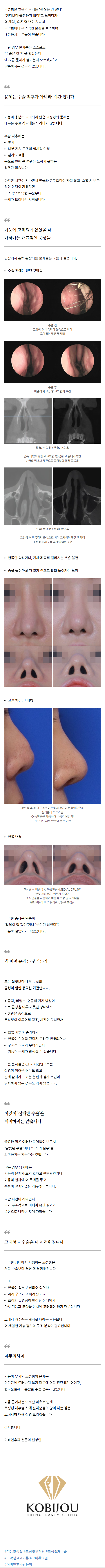 코성형외과유명한곳 iplhe