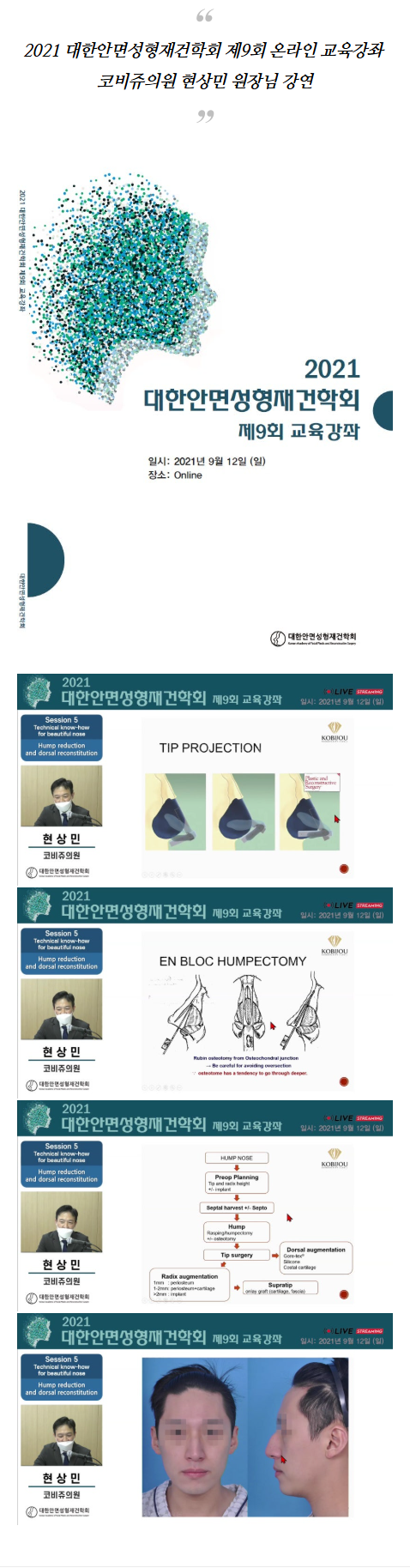 서울코재수술 lgfbe