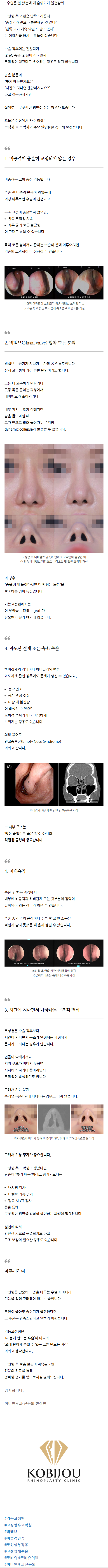 비밸브협착증수술 sbddp