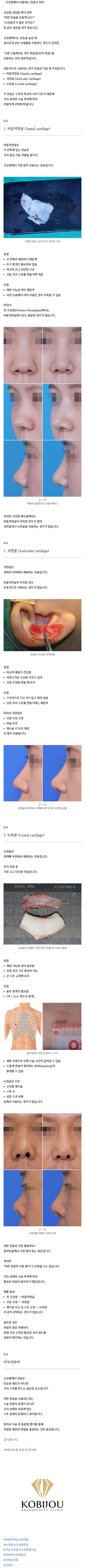 기능코성형잘하는곳 xiqbj