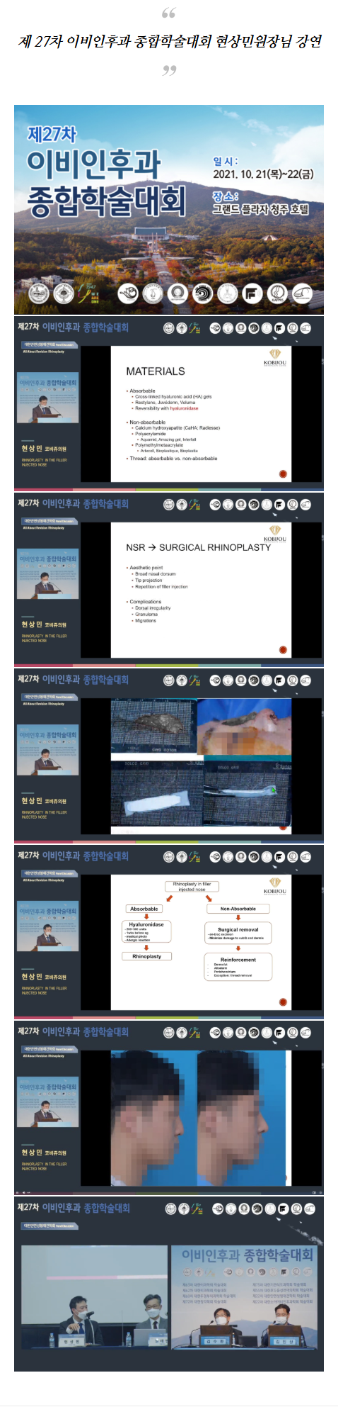 돼지코성형 gflyk