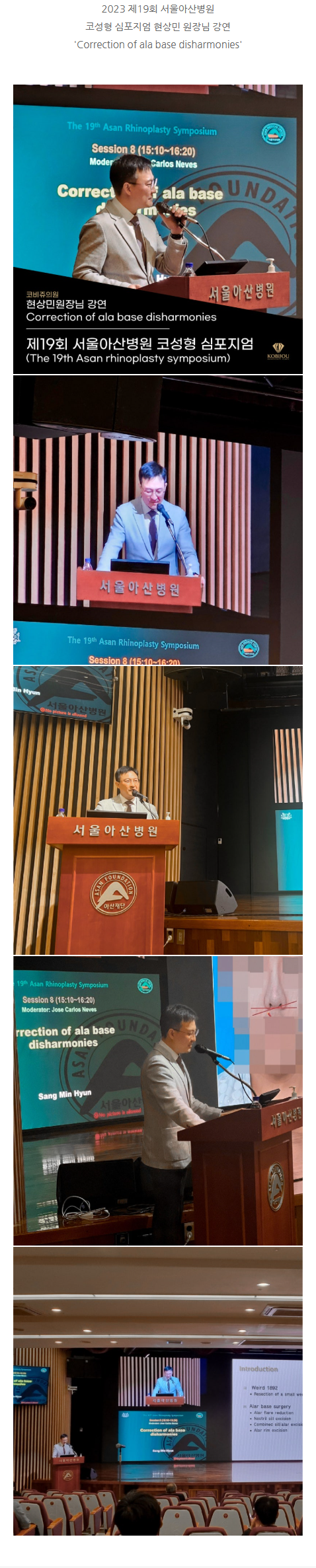 자연스러운코성형 vcpnt